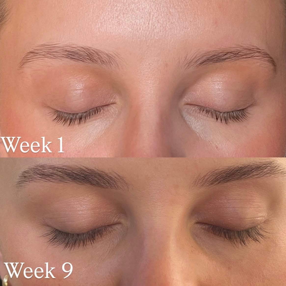 Best Eyelash Serum for Growth | Natural Lash & Brow Enhancer with
